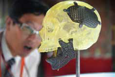 3D列印的頭蓋骨